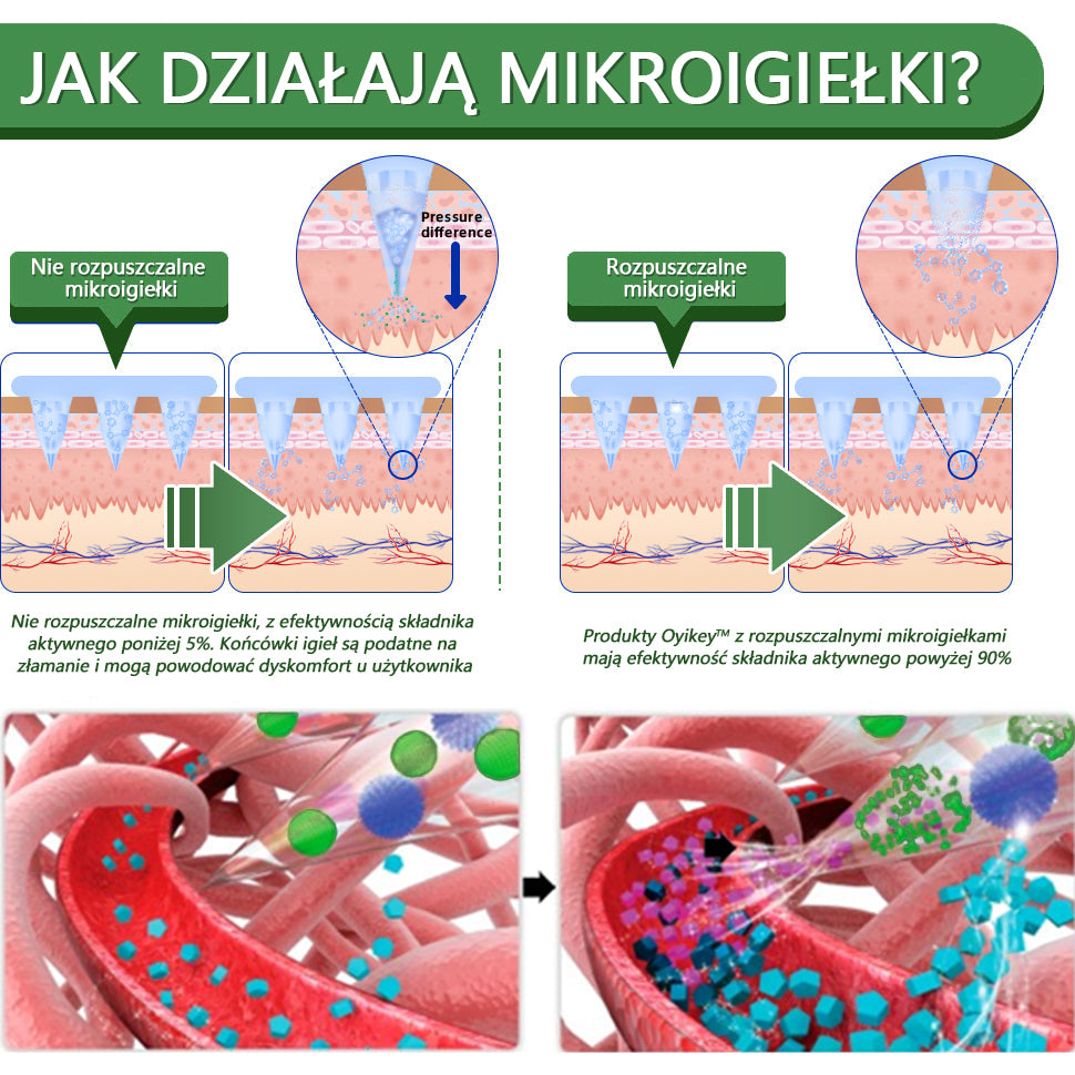 Voilaist® SMGT-GLP-1 Nano Microneedle Patch🍃Bezbolesny, długotrwały, zwalczający cukrzycę, otyłość i choroby układu krążenia🔥🔥🔥