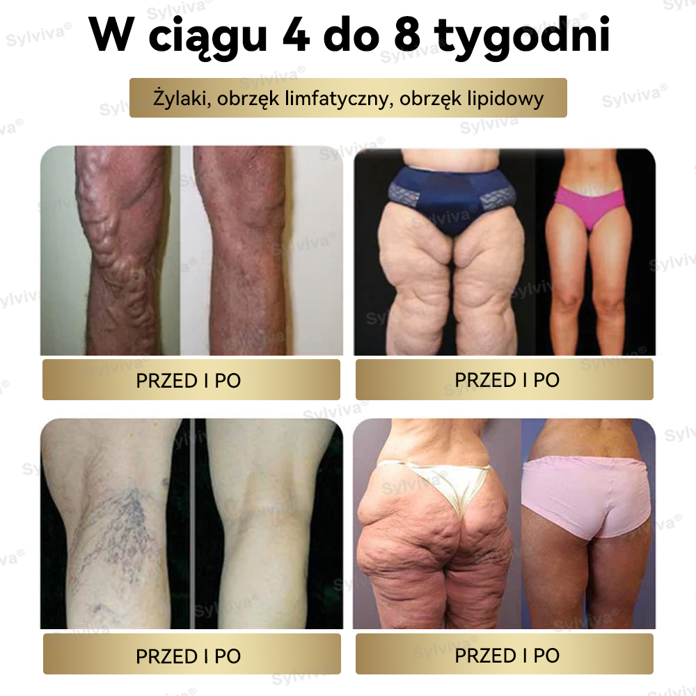 🔥Polecane przez Klinikę Mayo | Oficjalny sklep | Sylviva® GLP-1 Moringa – krople na odchudzanie i zdrowie 🔥 (Spalacz tłuszczu o jakości spożywczej – opracowany przez Towarzystwo Otyłości