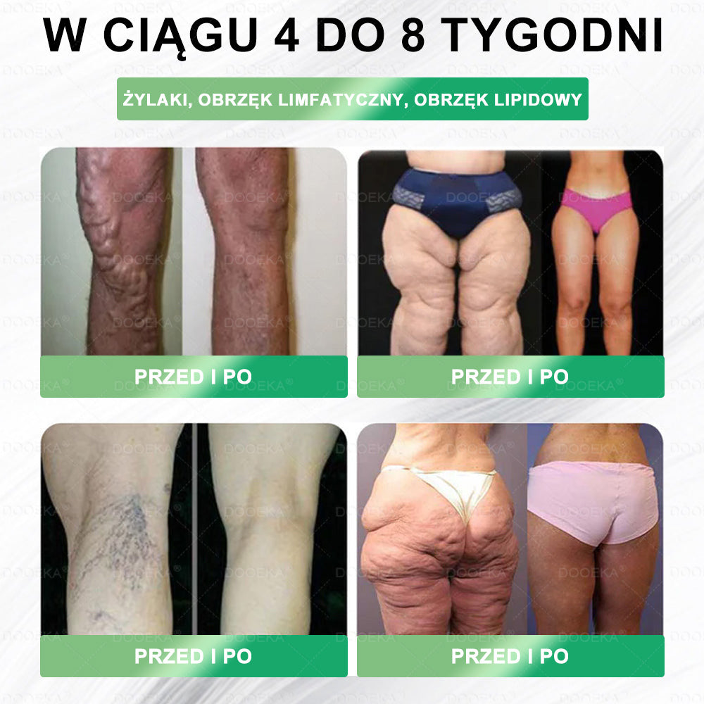🎁DOOEKA® GLP-1 8 w 1 Fit & Vital roztwór doustny – Raz dziennie, widoczne zmiany w ciągu 7 dni / W przypadku otyłości, zdrowia serca i układu krążenia, cukrzycy, bezdechu sennego, zdrowia jelit, problemów ze stawami i wielu innych